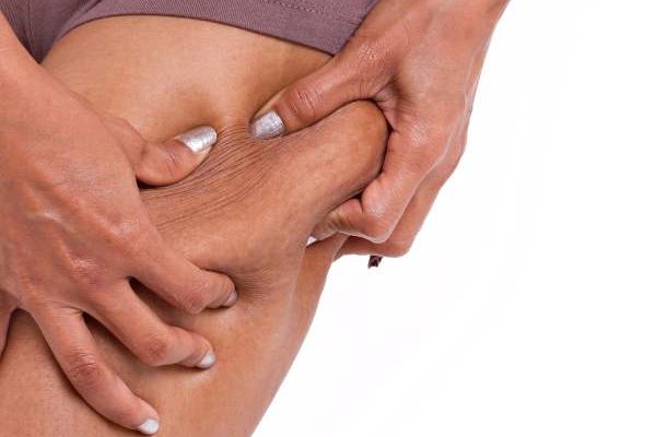 alidya intralipoterapia antes y despues madrid