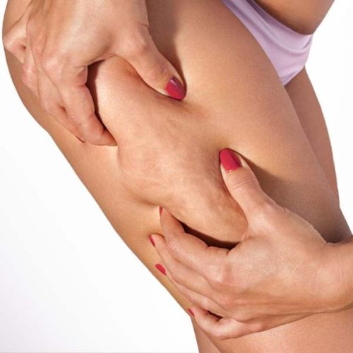 alidya que es. Clinica de Medicina Estetica EB en Madrid