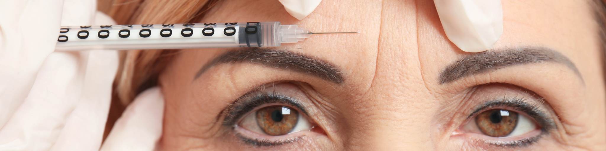 botox clinica medicina estetica eb en Madrid