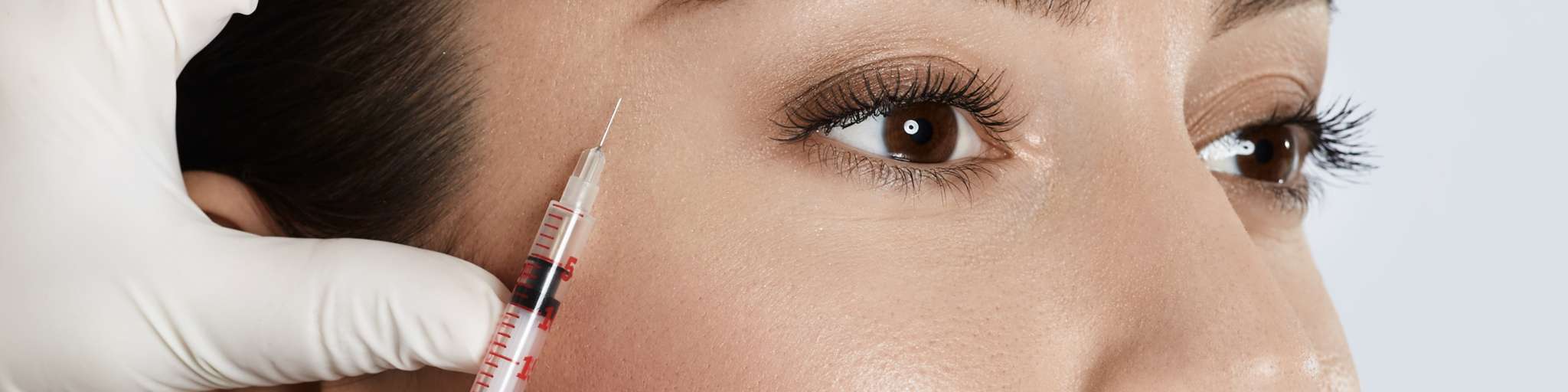 eliminar arrugas del rostro en madrid