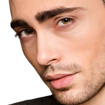 Quitar ojeras con acido hialuronico en la clinica de medicina estetica EB en Madrid