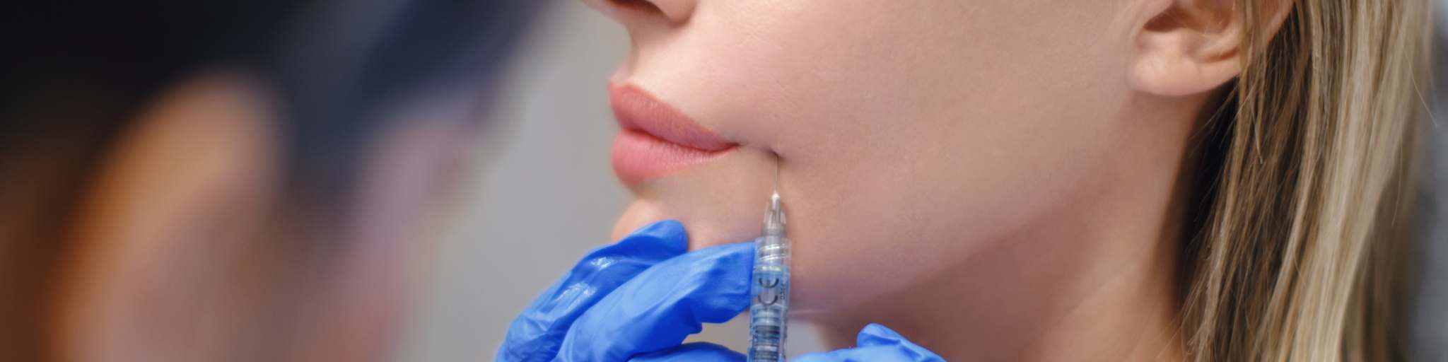 radiesse clínica medicina estética EB madrid