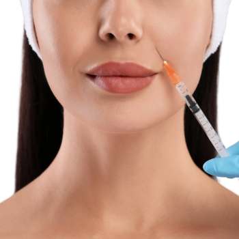 radiesse. que es. Efectos Secundarios
