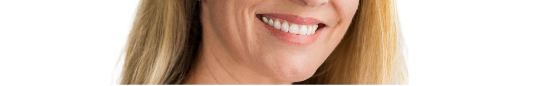 surco nasogeniano cuanto cuesta