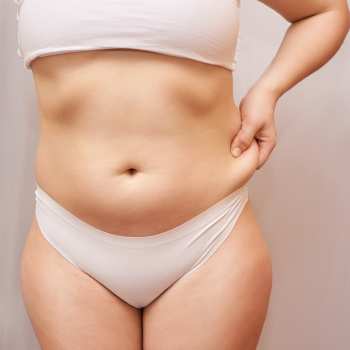 eliminar grasa localizada es posible gracias los tratamientos medicos estéticos avanzados de la Clinica de medicina estética EB