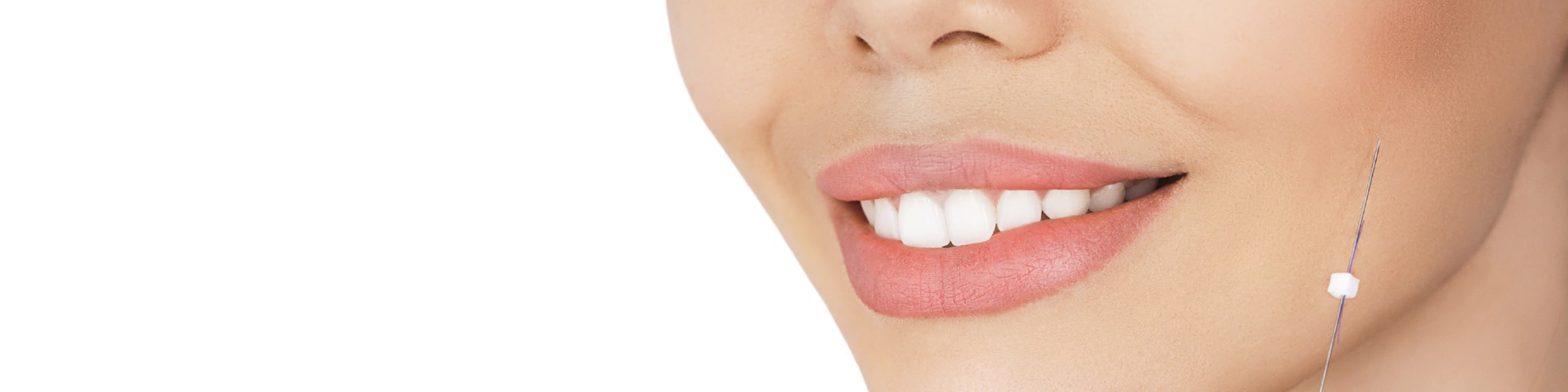 Ellansé tratamiento medico estético con efectos lifting facial