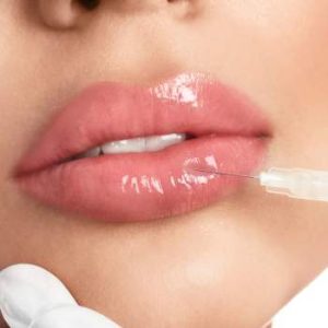 hidratación labios sin aumento en Madrid