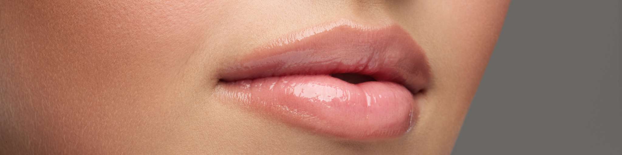 hidratación labios sin aumento con acido hialuronico Clinica Medicina Estetica EB