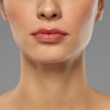 lifting con hidroxiapatita cálcica en madrid