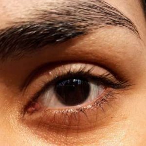 Como quitar ojeras. Tratamientos y remedios caseros