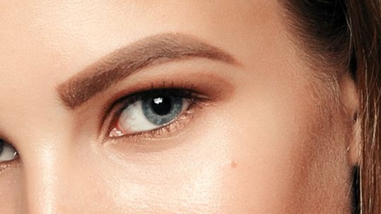 Pros y Contras del Relleno de Ojeras con acido hialuronico