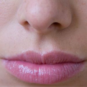 Labios Asimétricos
