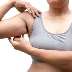 lifting brazos sin cirugía. Tratamiento de Coolsculpting en Brazos en la Clinica de medicina estetica EB