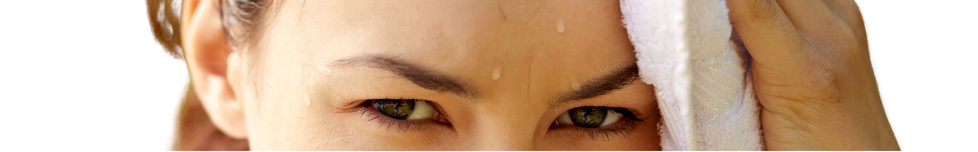 hiperdrosis botox Madrid tratamiento en la Clinica de Medicina Estetica EB