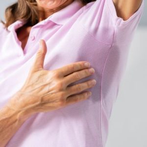 sudoracion intensa hiperhidrosis botox