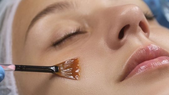 Peeling fenol en Madrid. Tratamiento de Peeling Químico en la Clinica de Medicina Estetica EB