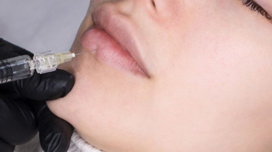 tratamientos medicos estéticos labios en la clinica de medicina estetica EB