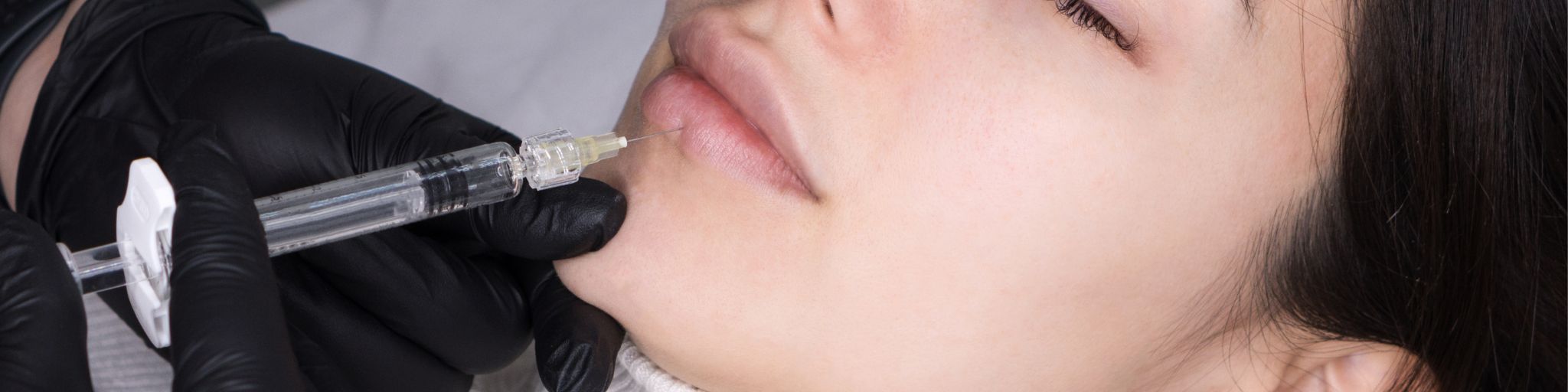 tratamientos medicos estéticos labios en la clinica de medicina estetica EB