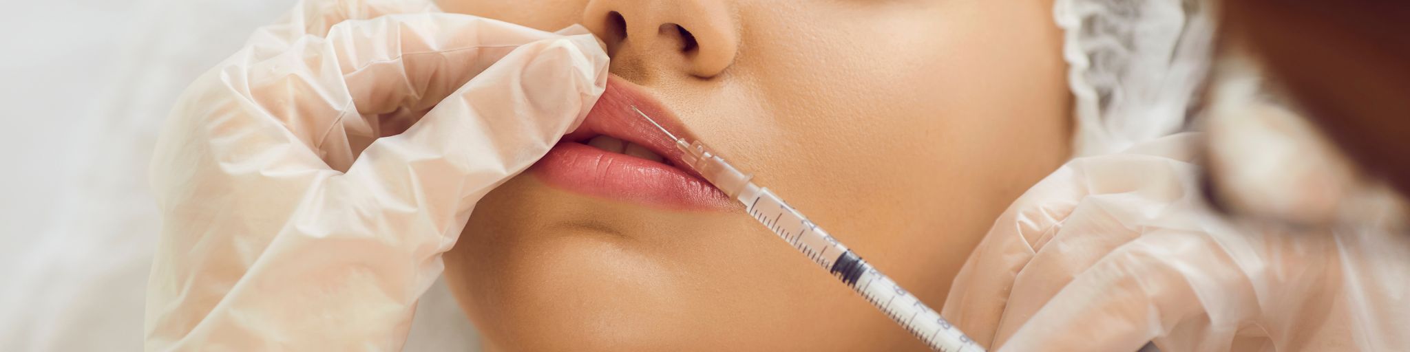 acido hialuronico efectos secundarios Madrid