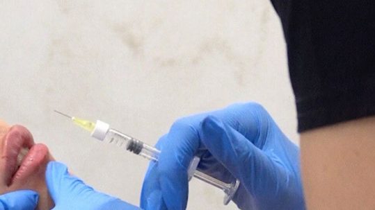 acido hialurónico labios cuidados tras el tratamiento