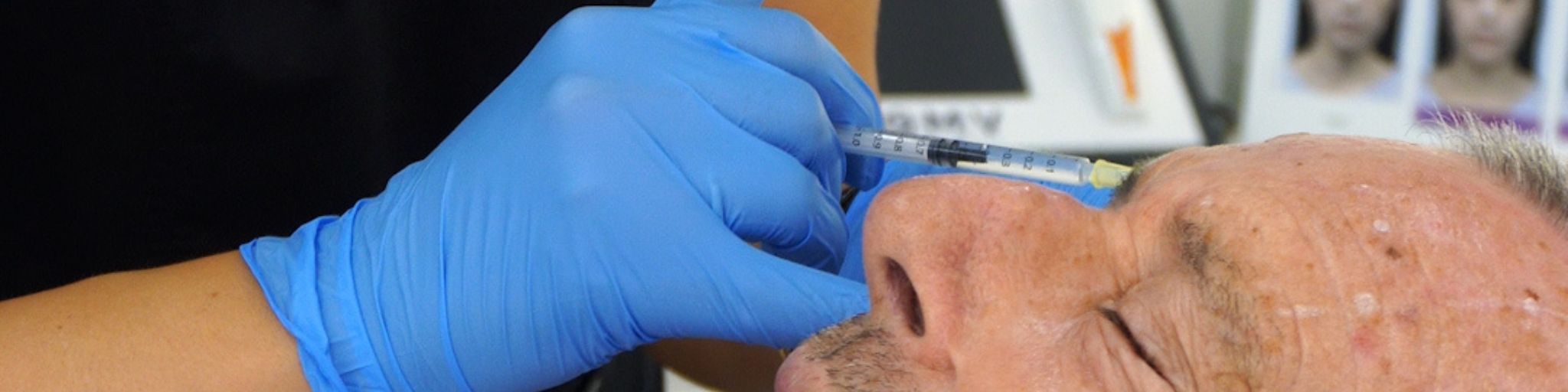 Botox precio en Madrid Tratamiento arrugas para la frente, entrecejo y patas de gallo