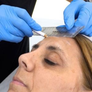 inyecciones botox precio y usos inyecciones botox precio y usos