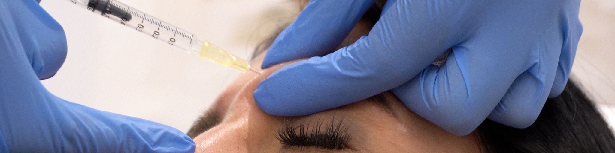 por que salen las arrugas y como eliminarlas. Tratamiento con botox