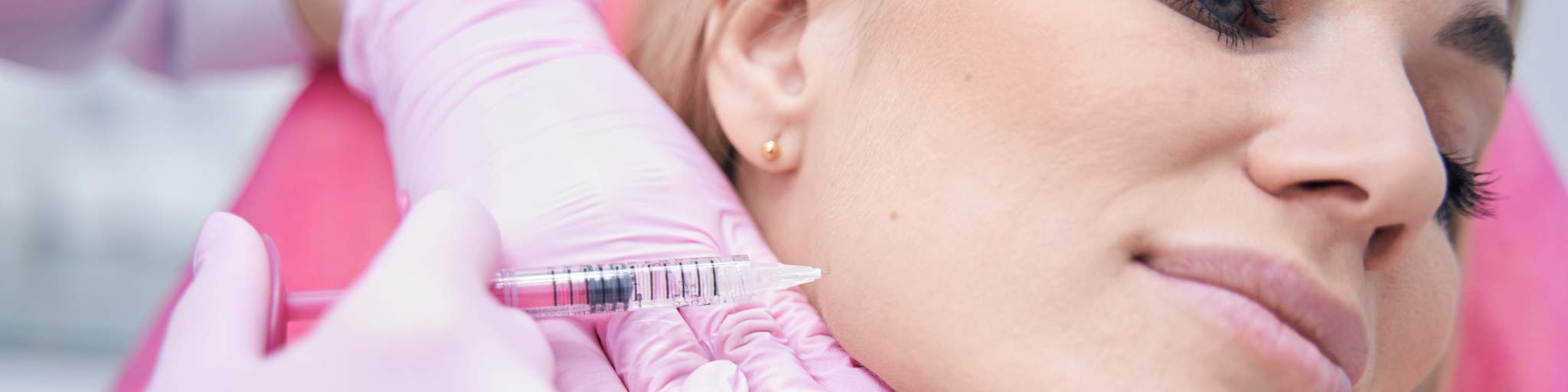 aumento de pomulos o relleno de pomulos con acido hialuronico