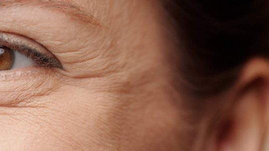 Quitar patas de gallo. Clínica de medicina estética EB