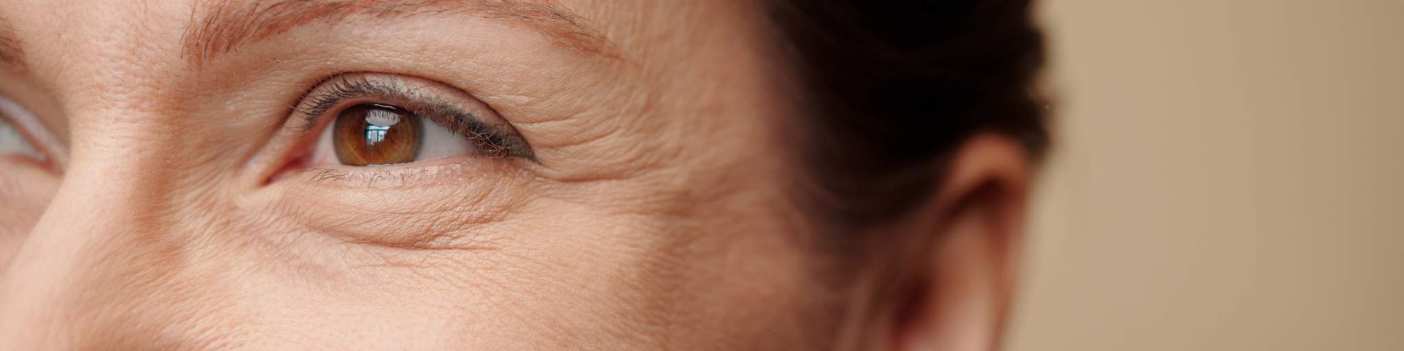 Quitar patas de gallo. Clínica de medicina estética EB