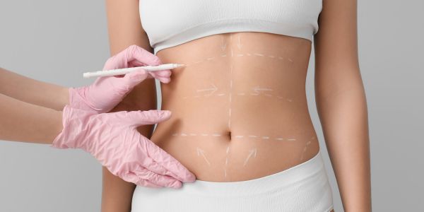 precios en tratamientos de medicina estetica Salamanca