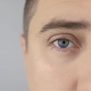 relleno de ojeras con acido hialuronico