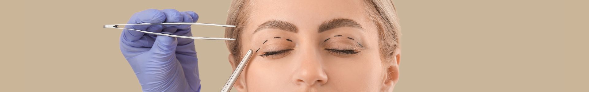 blefaroplastia madrid cirugia en Clinicas EB