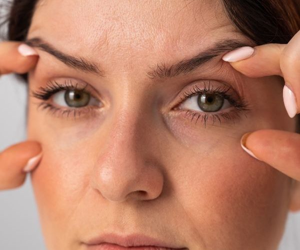 blefaroplastia precio inferior en la clinica de medicina estetica EB blefaroplastia precio inferior en la clinica de medicina estetica EB