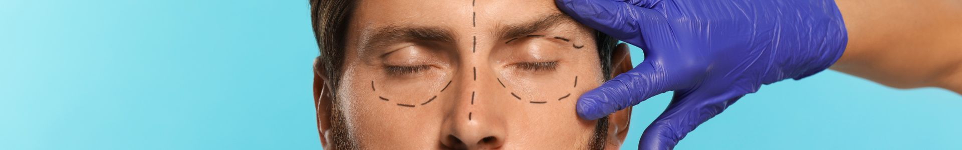blefaroplastia al mejor precio de Madrid con la Clinica de medicina estetica EB