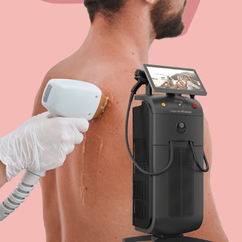 depilación laser cuerpo entero hombre