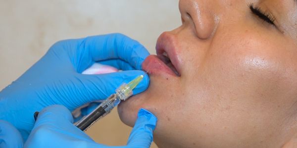 acido hialuronico clínica medicina estetica