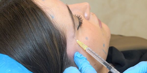 botox clinica medicina estética