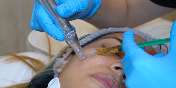 rejuvenecimiento facial clinica medicina estetica